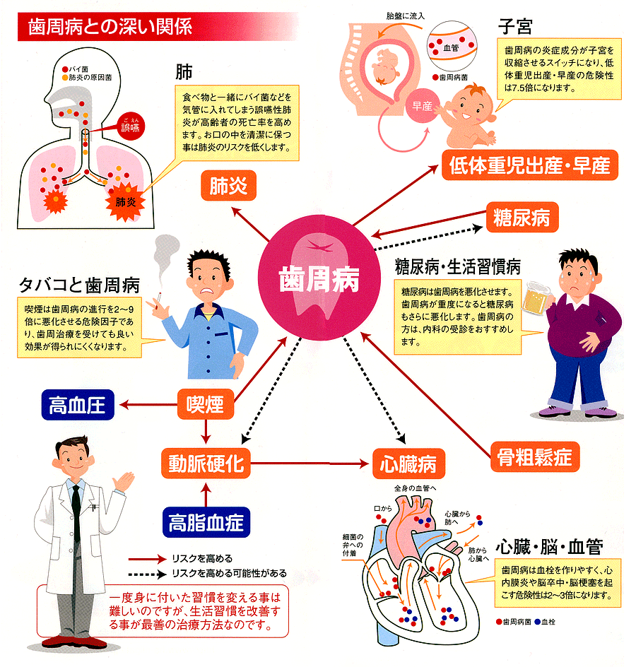 新しい健康科学への架け橋 歯周病と全身の健康を考える/医歯薬