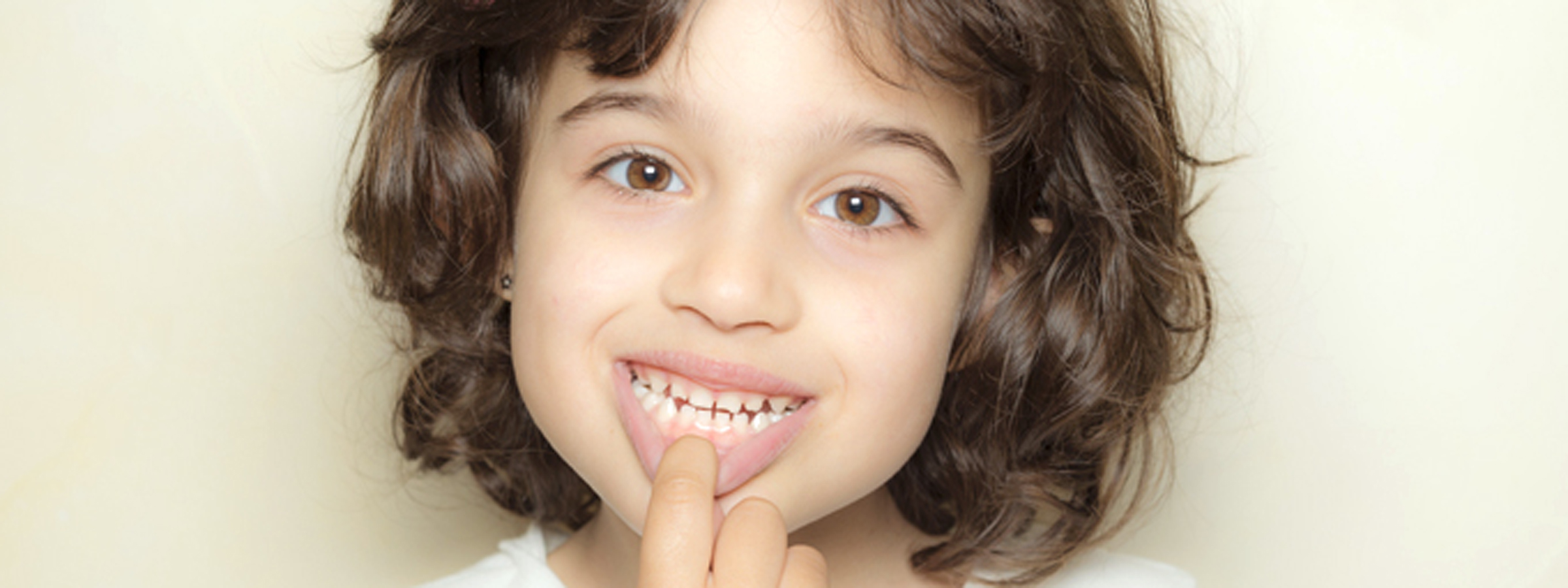 小児歯科 虫歯治療 岩見沢の歯医者なら鳩が丘歯科クリニック 矯正 インプラントに実績