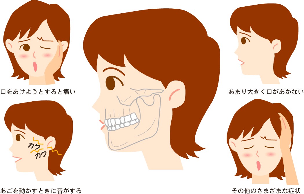 顎関節症の歯の痛みはどのように治療されますか?