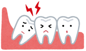 が 痒い 歯茎 歯周病 １０代や２０代にもリスク